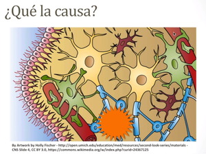 Neuropatía Diabética ¿Qué es? y ¿Que hacer?