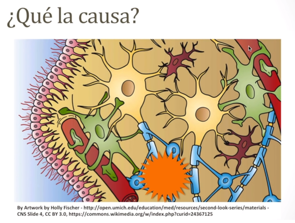 Neuropatía Diabética ¿Qué es? y ¿Que hacer?